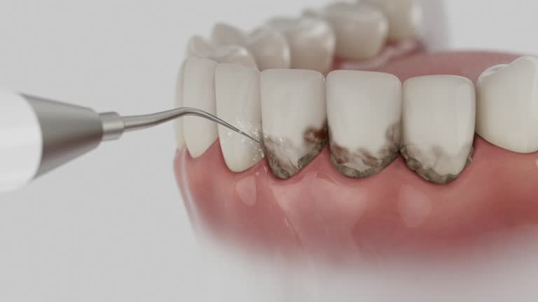 Reliable Dental Implants contractor in Slinger, WI by Smile Center Dentistry